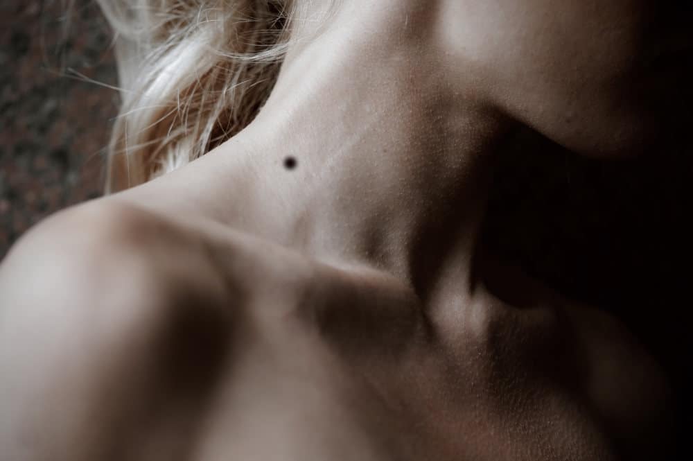 Moles On The Neck Meaning